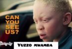 Story Ya Albino By Yuzzo Mwamba